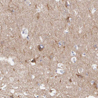 Immunohistochemical staining of human cerebral cortex shows moderate cytoplasmic positivity in neurons.