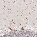 Anti-CEP170B Antibody