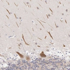 Immunohistochemical staining of human cerebellum shows strong cytoplasmic positivity in Purkinje cells.