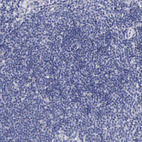 Anti-CEP170B Antibody
