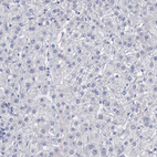 Immunohistochemical staining of human liver shows no cytoplasmic positivity in hepatocytes as expected.