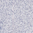 Immunohistochemical staining of human liver shows no cytoplasmic positivity in hepatocytes as expected.