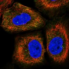 Immunofluorescent staining of human cell line HaCaT shows localization to cytosol & centrosome.