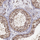 Anti-PSMC1 Antibody