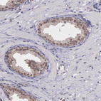 Immunohistochemical staining of human prostate shows moderate nuclear positivity in glandular cells.