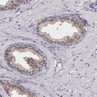 Immunohistochemical staining of human prostate shows moderate nuclear positivity in glandular cells.