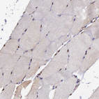 Immunohistochemical staining of human skeletal muscle shows moderate nuclear positivity in myocytes.