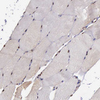 Anti-PSMC1 Antibody