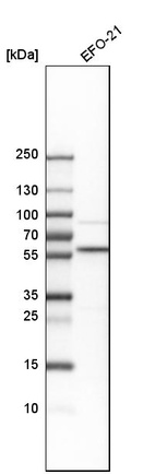 Western blot analysis in human cell line EFO-21.