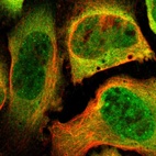 Immunofluorescent staining of human cell line U-2 OS shows localization to nucleoplasm & cytosol.