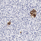 Anti-DGCR2 Antibody