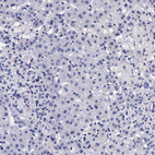 Anti-DGCR2 Antibody