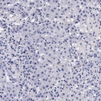 Immunohistochemical staining of human liver shows no positivity in hepatocytes as expected.