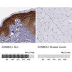 Anti-AHNAK2 Antibody