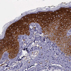 Immunohistochemical staining of human skin shows strong cytoplasmic positivity in squamous epithelial cells.