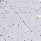 Immunohistochemical staining of human skeletal muscle shows no positivity in myocytes as expected.