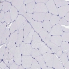 Immunohistochemical staining of human skeletal muscle shows no positivity in myocytes as expected.