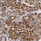 Anti-FRMD7 Antibody