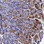 Anti-CCDC22 Antibody