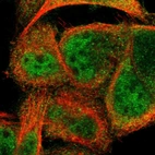 Immunofluorescent staining of human cell line A-431 shows localization to nucleoplasm & cytosol.