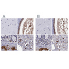 Anti-SERPINA3 Antibody