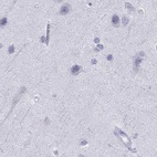 Immunohistochemical staining of human cerebral cortex using Anti-SERPINA3 antibody HPA000893.