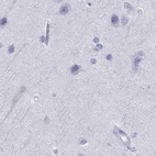 Anti-SERPINA3 Antibody