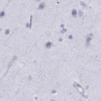 Immunohistochemical staining of human cerebral cortex using Anti-SERPINA3 antibody HPA000893.