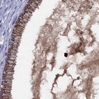 Immunohistochemical staining of human cervix, uterine using Anti-SERPINA3 antibody HPA000893.