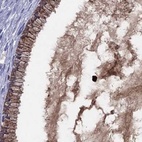 Anti-SERPINA3 Antibody