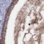 Immunohistochemical staining of human cervix, uterine using Anti-SERPINA3 antibody HPA000893.