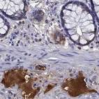 Immunohistochemical staining of human colon using Anti-SERPINA3 antibody HPA000893.