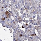 Immunohistochemical staining of human liver using Anti-SERPINA3 antibody HPA000893.
