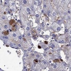 Anti-SERPINA3 Antibody