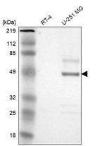 Western blot analysis in human cell line RT-4 and human cell line U-251 MG.