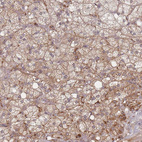 Anti-CXorf57 Antibody