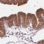 Anti-CXorf57 Antibody