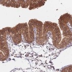Immunohistochemical staining of human Fallopian tube shows strong cytoplasmic positivity in glandular cells.