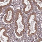 Immunohistochemical staining of human endometrium shows strong membranous and cytoplasmic positivity in glandular cells.