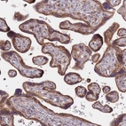 Immunohistochemical staining of human placenta shows strong membranous and cytoplasmic positivity in trophoblastic cells.