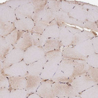 Immunohistochemical staining of human skeletal muscle shows very weak cytoplasmic positivity in myocytes.