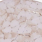 Immunohistochemical staining of human skeletal muscle shows very weak cytoplasmic positivity in myocytes.