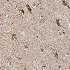 Immunohistochemical staining of human cerebral cortex shows strong positivity in mitochondria in neurons.