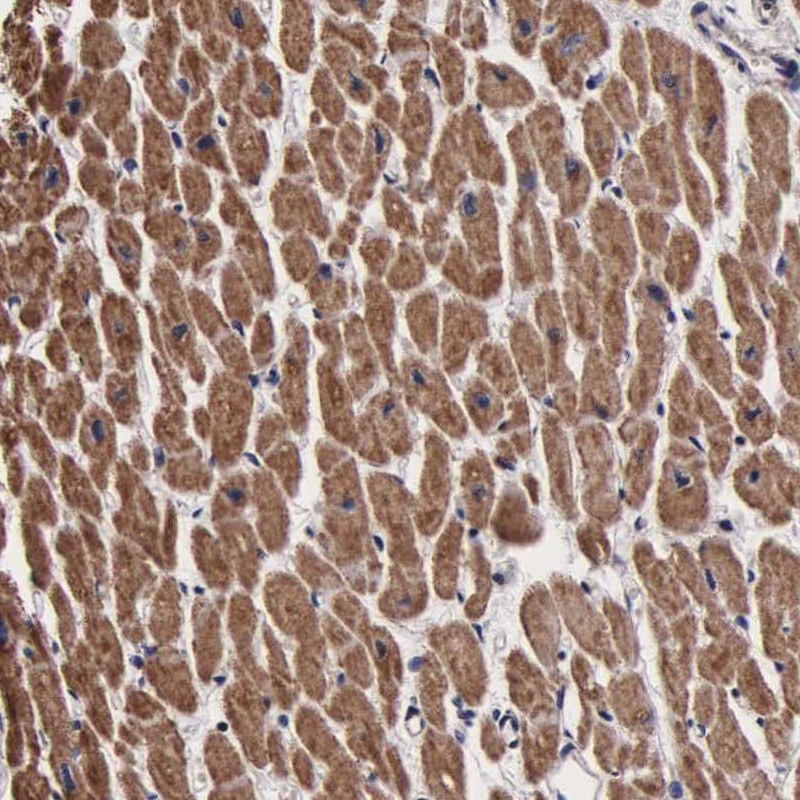 Anti-PSMA3 Antibody
