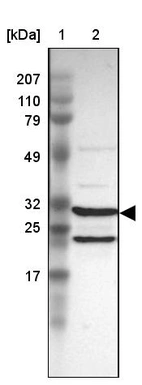 Lane 1: Marker [kDa] 207, 110, 79, 49, 32, 25, 17_br/_Lane 2: Human cell line RT-4