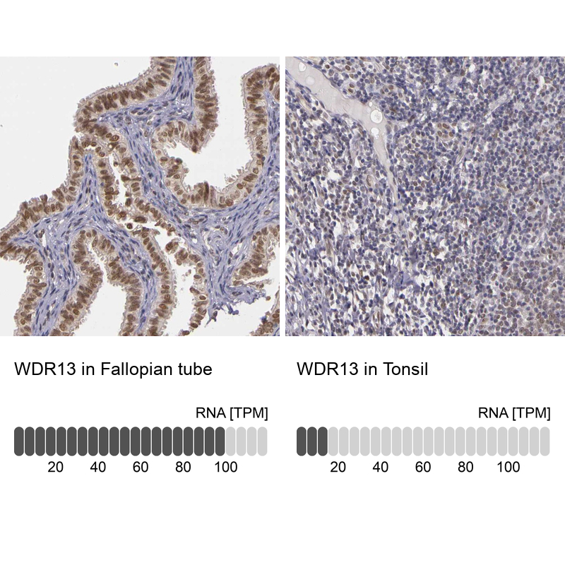 Anti-WDR13 Antibody