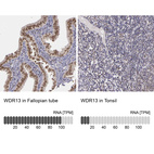 Anti-WDR13 Antibody