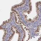 Immunohistochemical staining of human fallopian tube shows high expression.