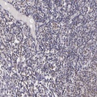 Anti-WDR13 Antibody