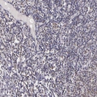 Immunohistochemical staining of human tonsil shows low expression as expected.